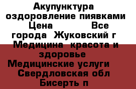 Акупунктура, оздоровление пиявками › Цена ­ 3 000 - Все города, Жуковский г. Медицина, красота и здоровье » Медицинские услуги   . Свердловская обл.,Бисерть п.